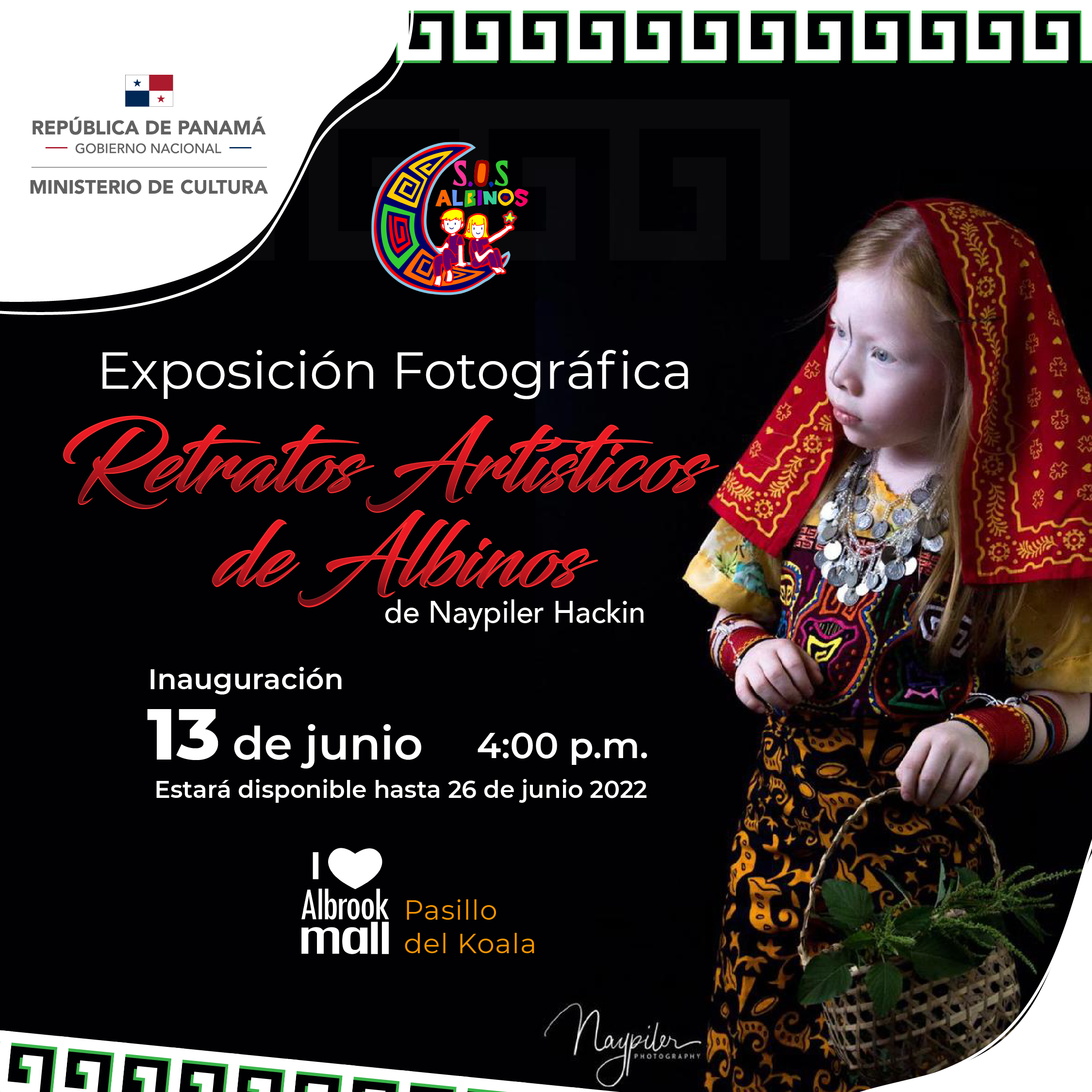 MiCultura PRESS PHOTOGRAFFIC EXPOSITION TO CREATE CONCIENCE ON ALBINISM