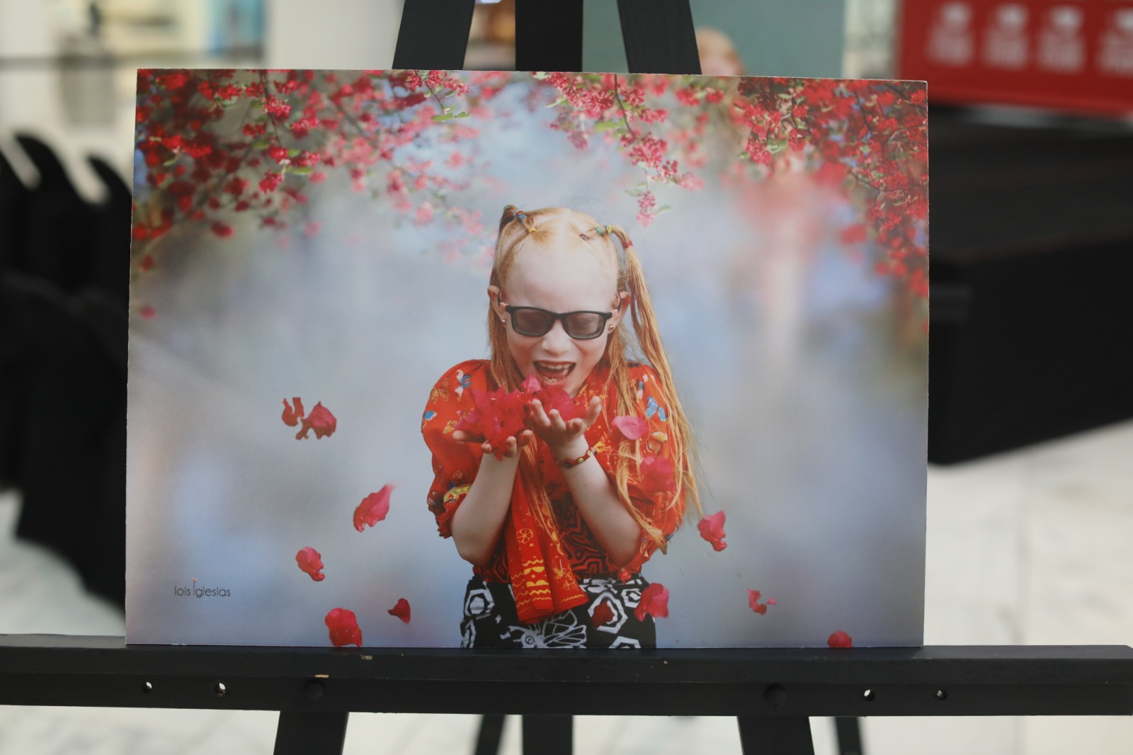 EXPOSITS TO CONOcER THE ALBINISM ITEM IN PANAMA